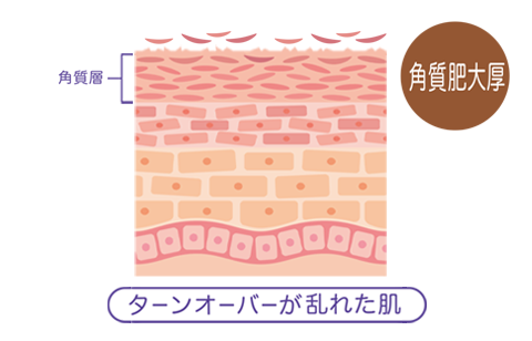 図：ターンオーバーが乱れた肌