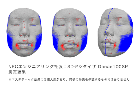 フェイスラインを引き締める！！顔やせ効果