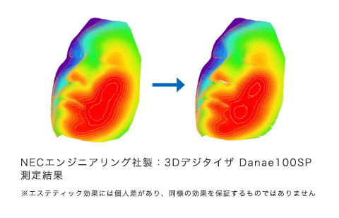 図：総消費カロリー