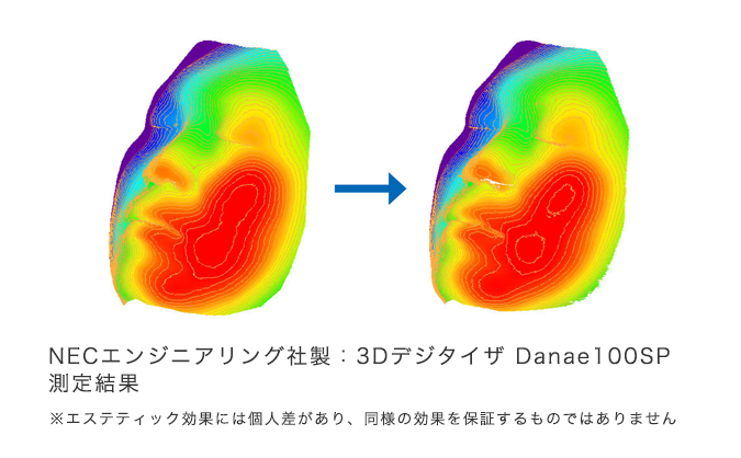 図：総消費カロリー