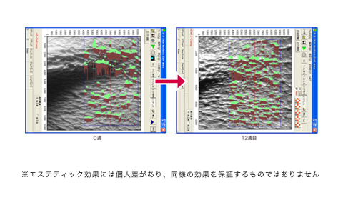 写真：生コラーゲンの力を最大限に導く技術