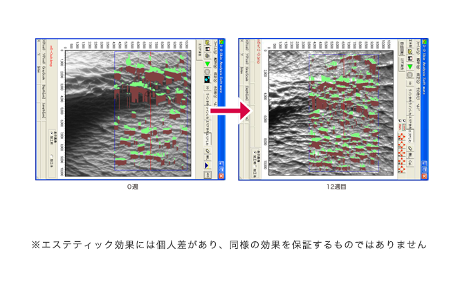 写真：生コラーゲンの力を最大限に導く技術