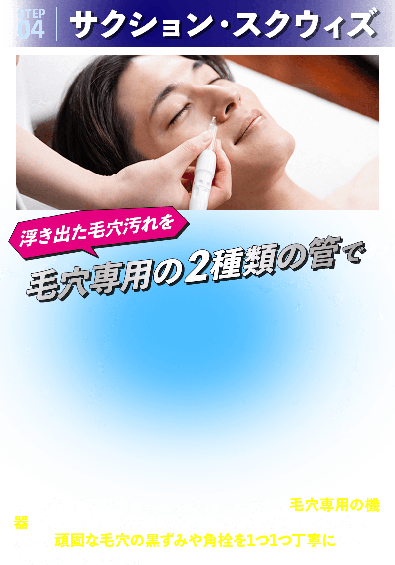 サクション・スクウィズ