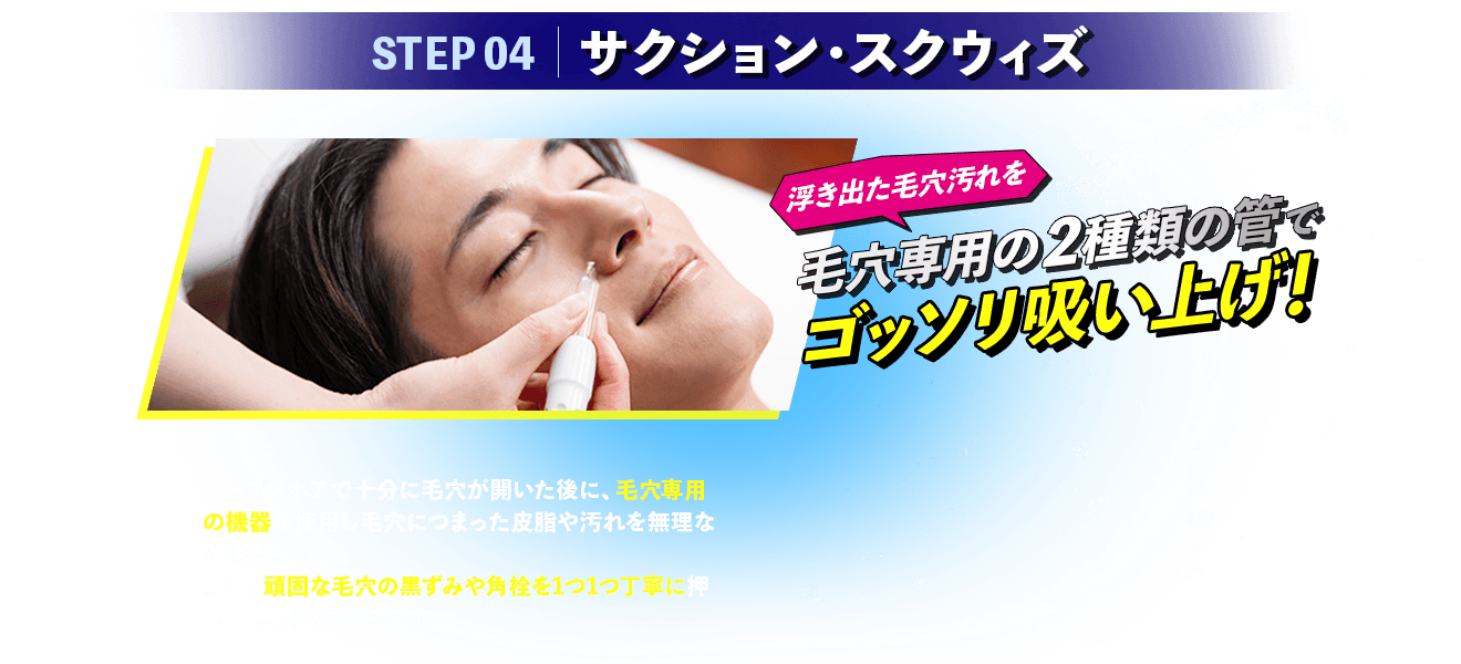 サクション・スクウィズ