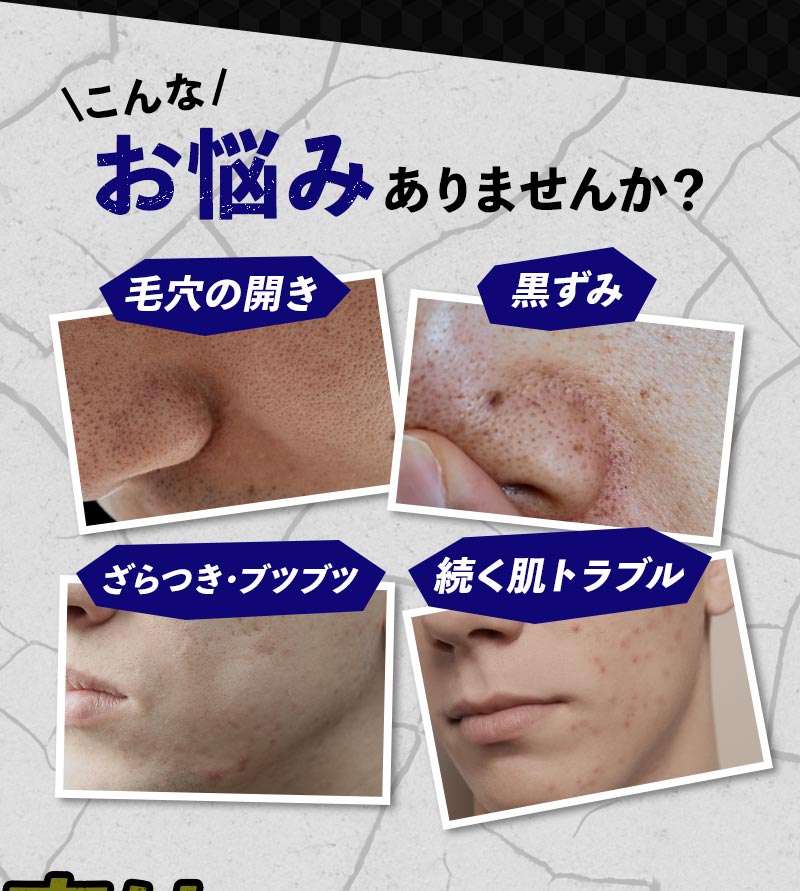 こんなお悩みありませんか？ 毛穴の開き・黒ずみ・ざらつき・ブツブツ・続く肌トラブル