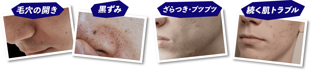 毛穴の開き・黒ずみ・ざらつき・ブツブツ・続く肌トラブル