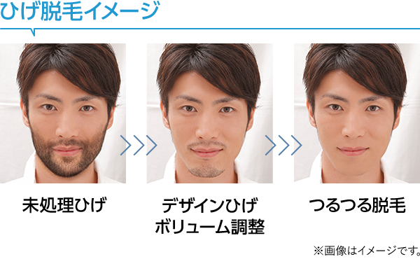 男の脱毛 キャンペーン お得情報 メンズエステなら 男のエステ ダンディハウス 男の脱毛 キャンペーン お得情報 メンズエステなら 男のエステ ダンディハウス