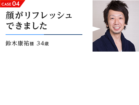 CASE04 顔がリフレッシュできました