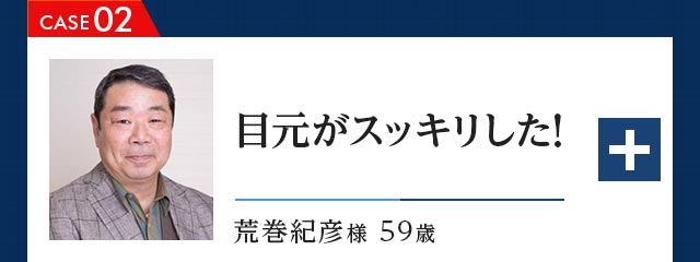 CASE02 目元がスッキリした！