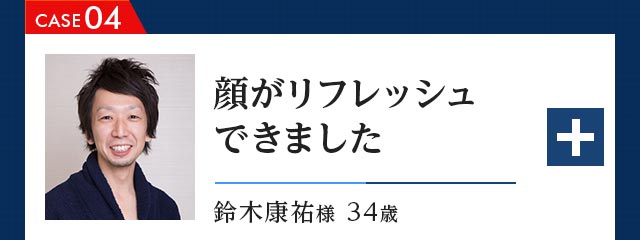 CASE04 顔がリフレッシュできました